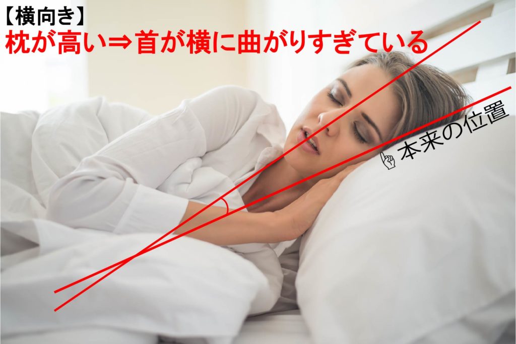 横向きで寝ている場合でも朝の頭痛は発生します