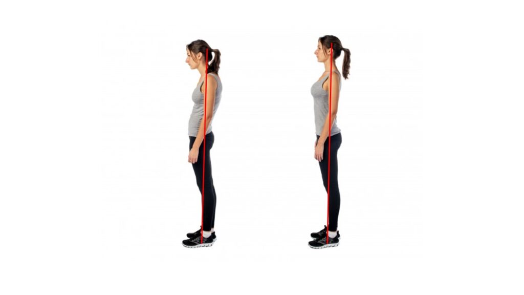 猫背による首痛