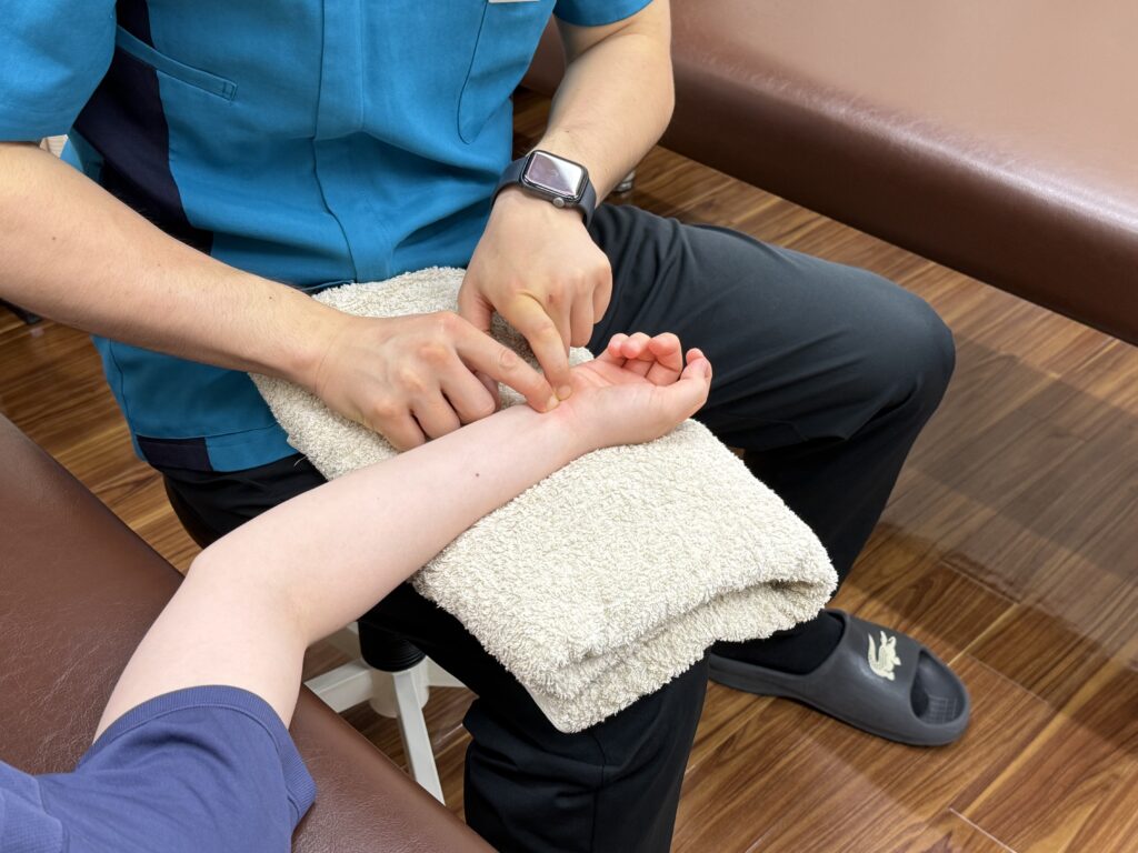 手首の筋膜リリース施術を受けている人の写真
